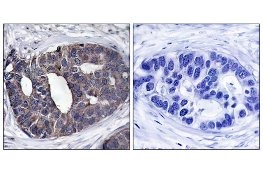 Immunohistochemistry - Anti-p62 Dok Antibody (B7057) - Antibodies.com