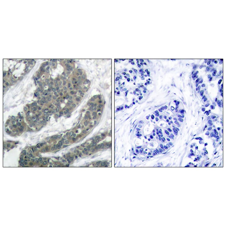 Immunohistochemistry - Anti-p62 Dok Antibody (B7058) - Antibodies.com