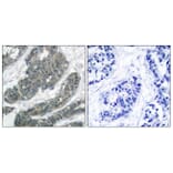 Immunohistochemistry - Anti-p62 Dok Antibody (B7058) - Antibodies.com