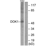 Western Blot - Anti-p62 Dok Antibody (B7058) - Antibodies.com