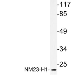 Western Blot - Anti-NM23-H1 Antibody (R12-2266) - Antibodies.com