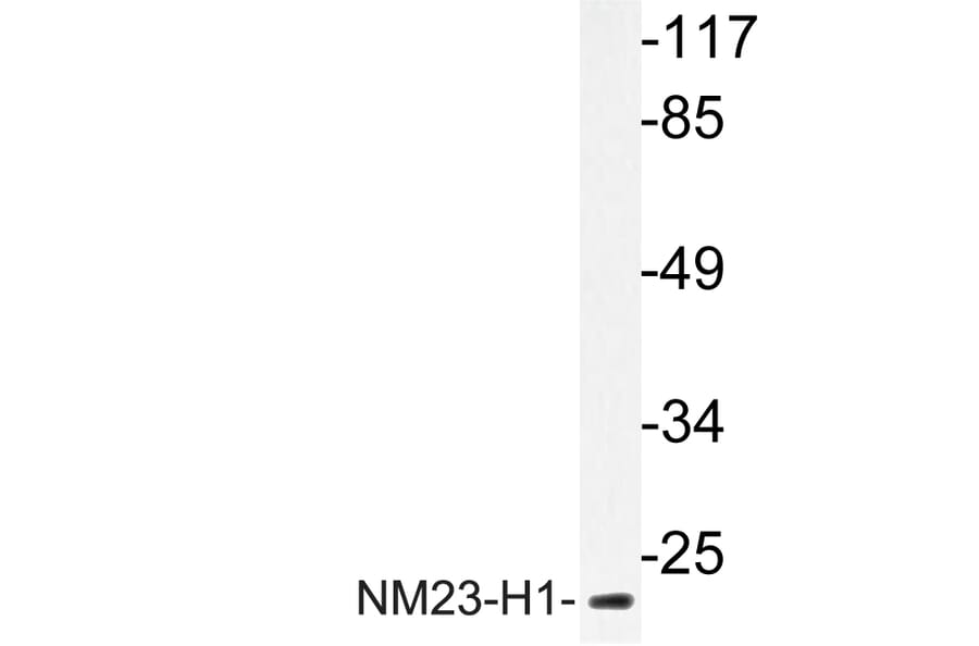 Western Blot - Anti-NM23-H1 Antibody (R12-2266) - Antibodies.com