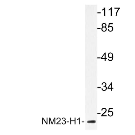 Western Blot - Anti-NM23-H1 Antibody (R12-2266) - Antibodies.com