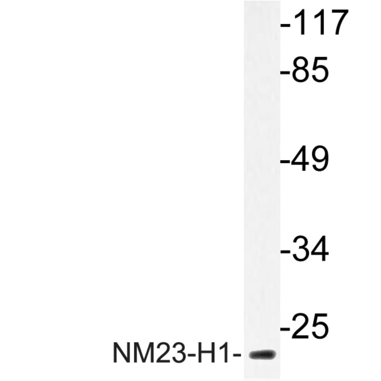 Western Blot - Anti-NM23-H1 Antibody (R12-2266) - Antibodies.com