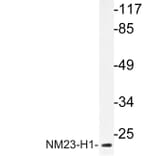 Western Blot - Anti-NM23-H1 Antibody (R12-2266) - Antibodies.com