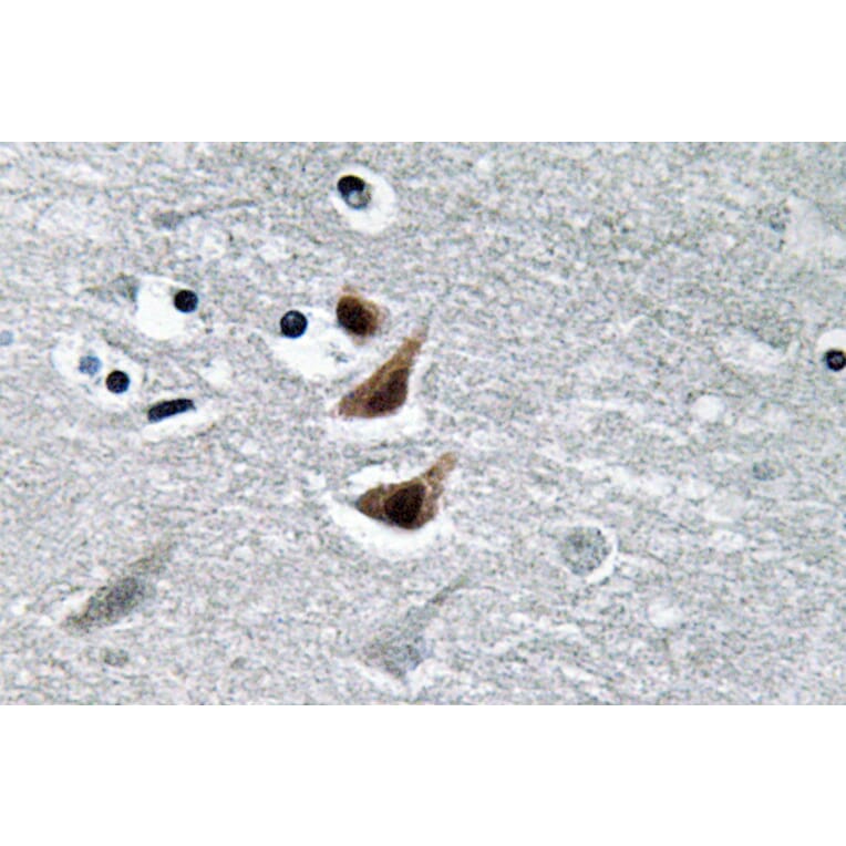 Immunohistochemistry - Anti-NM23-H1 Antibody (R12-2266) - Antibodies.com