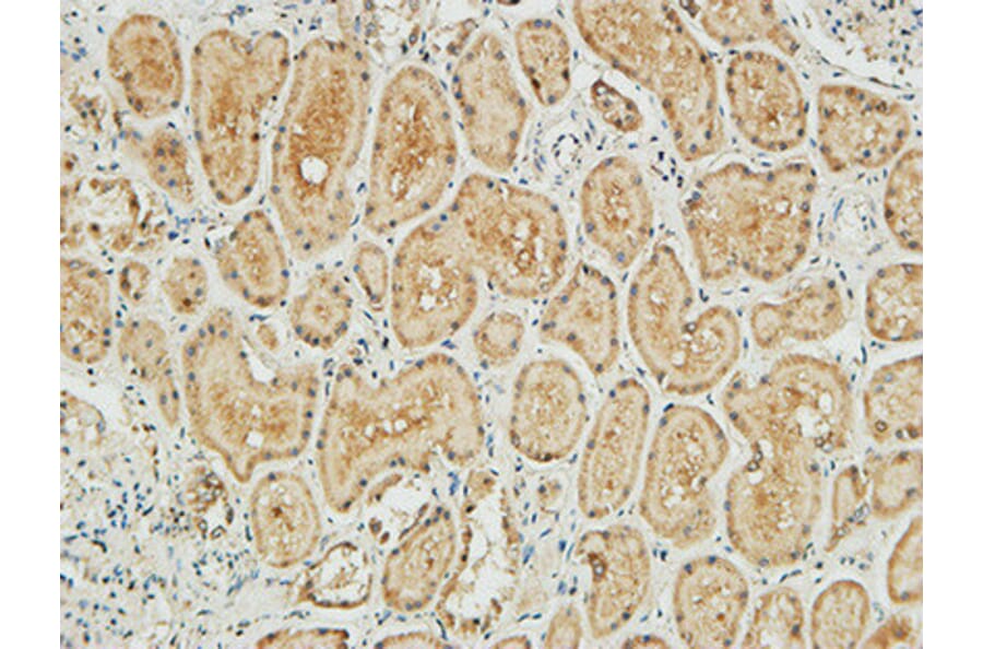 Immunohistochemistry - Anti-NM23-H1 Antibody (R12-2266) - Antibodies.com