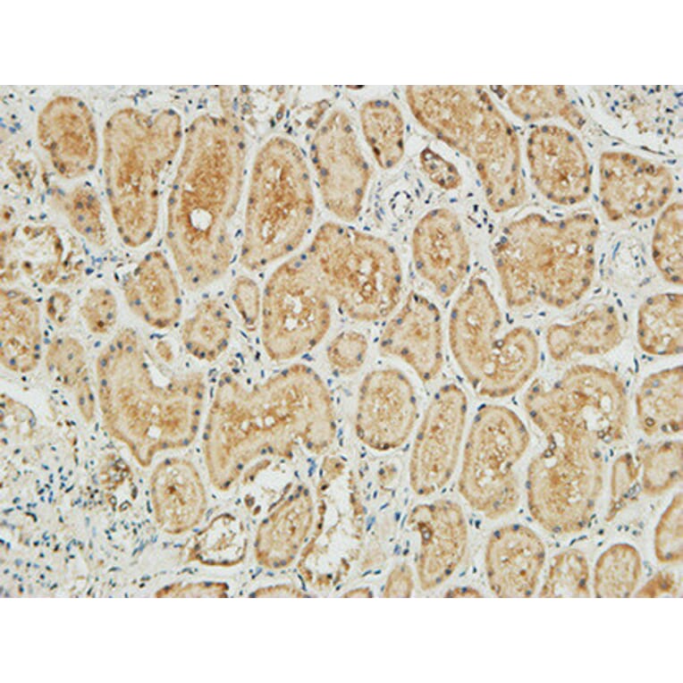 Immunohistochemistry - Anti-NM23-H1 Antibody (R12-2266) - Antibodies.com