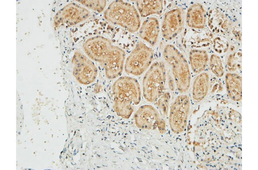 Immunohistochemistry - Anti-NM23-H1 Antibody (R12-2266) - Antibodies.com