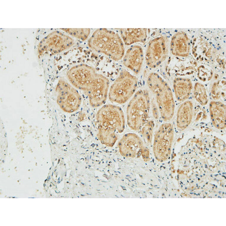 Immunohistochemistry - Anti-NM23-H1 Antibody (R12-2266) - Antibodies.com
