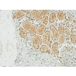Immunohistochemistry - Anti-NM23-H1 Antibody (R12-2266) - Antibodies.com