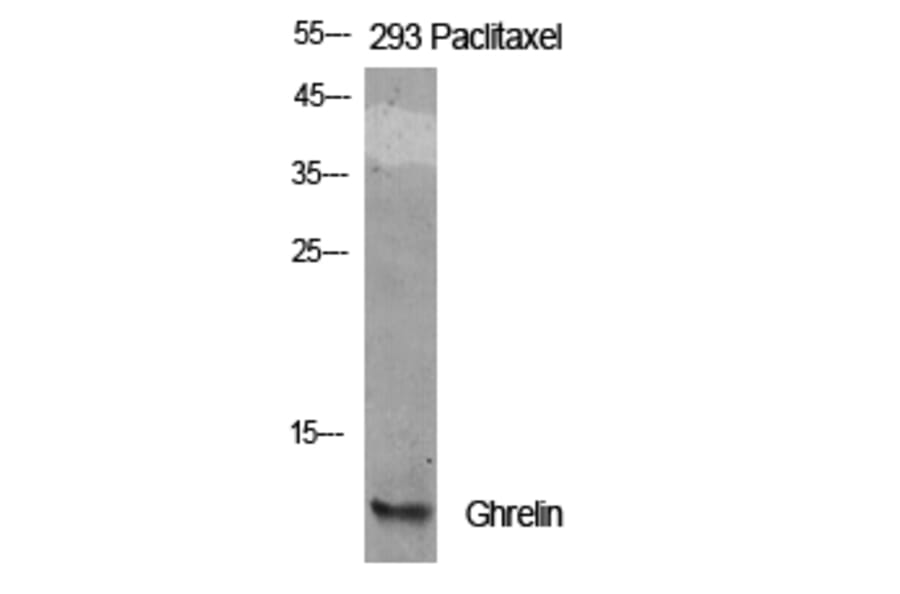 Western Blot - Anti-Ghrelin Antibody (R12-2164) - Antibodies.com