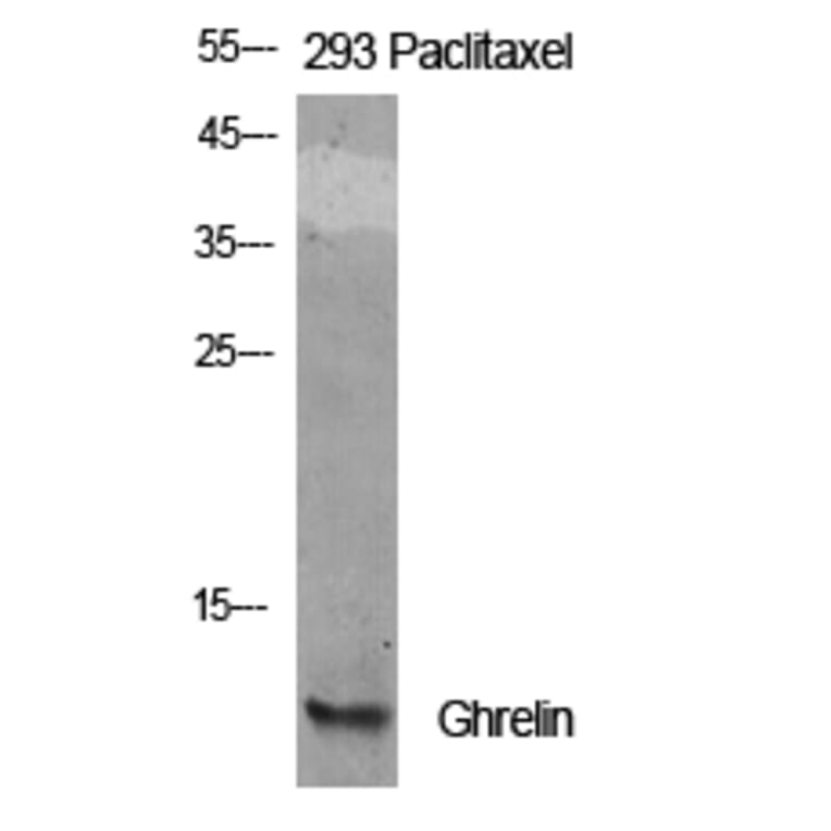 Western Blot - Anti-Ghrelin Antibody (R12-2164) - Antibodies.com