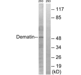 Western Blot - Anti-Dematin Antibody (B0904) - Antibodies.com