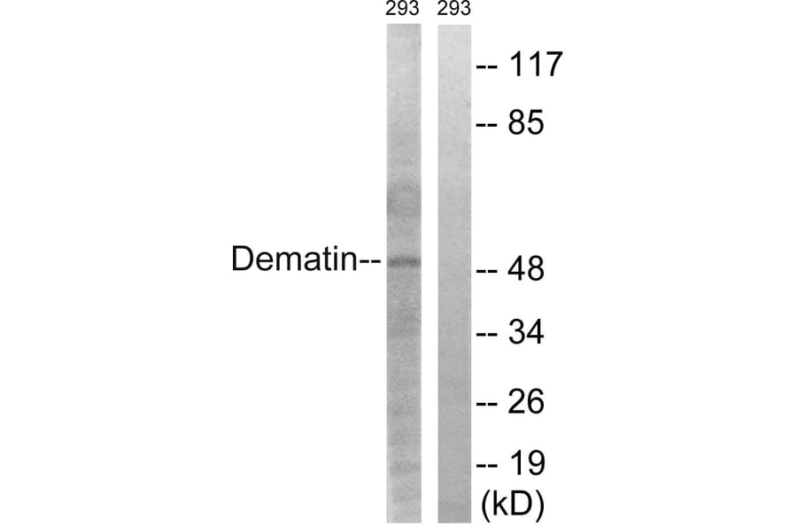 Western Blot - Anti-Dematin Antibody (B0904) - Antibodies.com