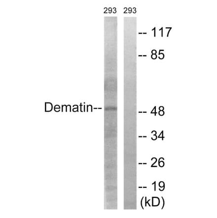 Western Blot - Anti-Dematin Antibody (B0904) - Antibodies.com