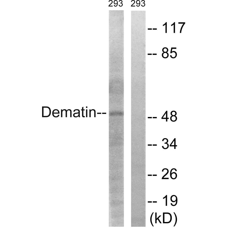 Western Blot - Anti-Dematin Antibody (B0904) - Antibodies.com