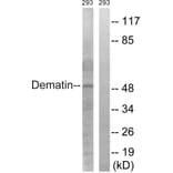 Western Blot - Anti-Dematin Antibody (B0904) - Antibodies.com
