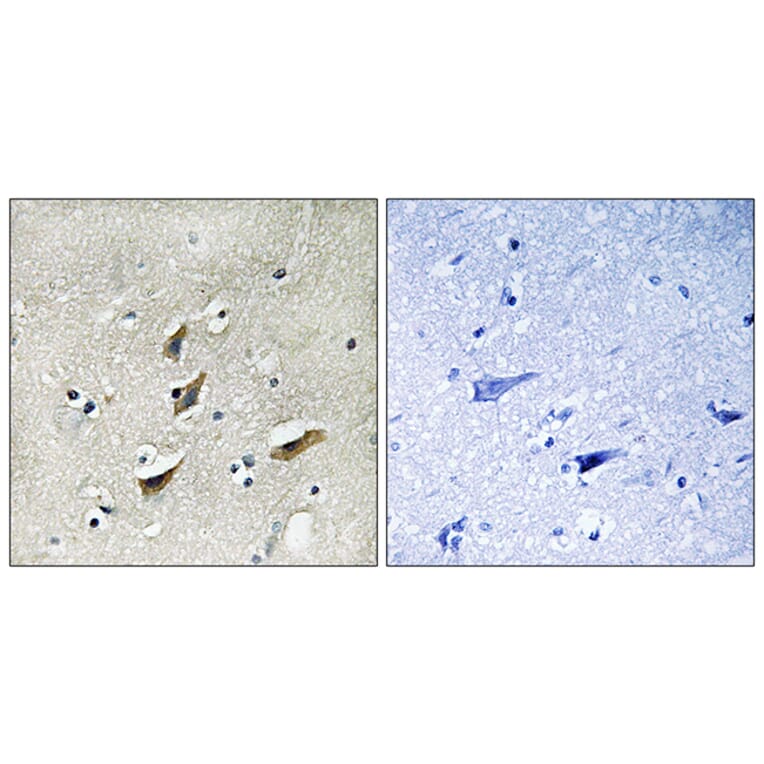 Immunohistochemistry - Anti-Dematin Antibody (B0904) - Antibodies.com