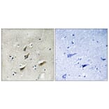 Immunohistochemistry - Anti-Dematin Antibody (B0904) - Antibodies.com