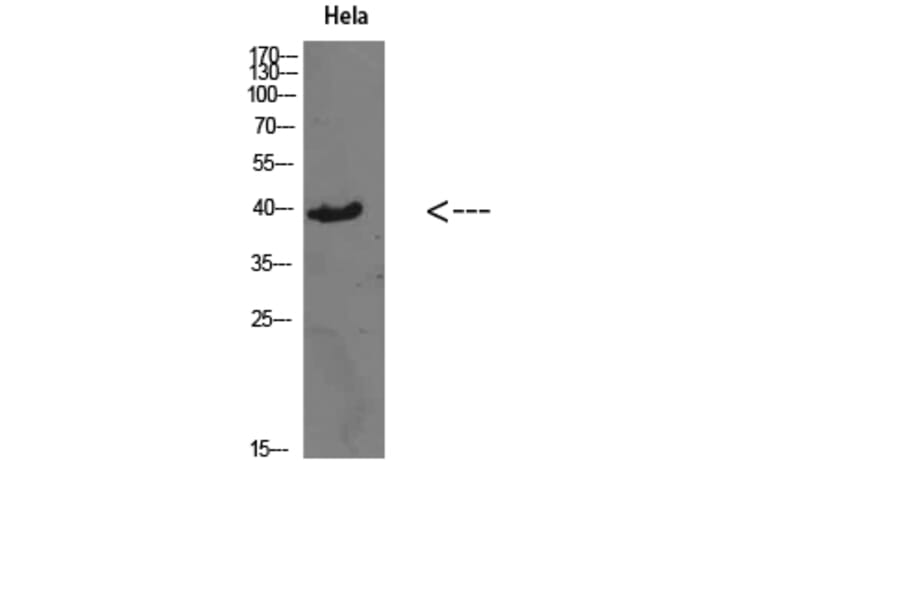 Western Blot - Anti-CSNK1A1 Antibody (C30815) - Antibodies.com