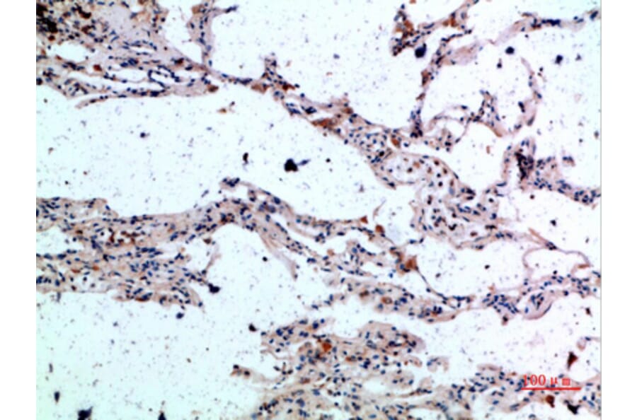 Immunohistochemistry - Anti-CSNK1A1 Antibody (C30815) - Antibodies.com