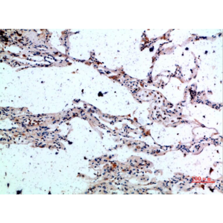 Immunohistochemistry - Anti-CSNK1A1 Antibody (C30815) - Antibodies.com