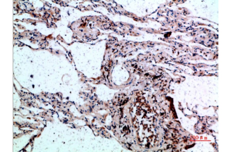 Immunohistochemistry - Anti-CSNK1A1 Antibody (C30815) - Antibodies.com