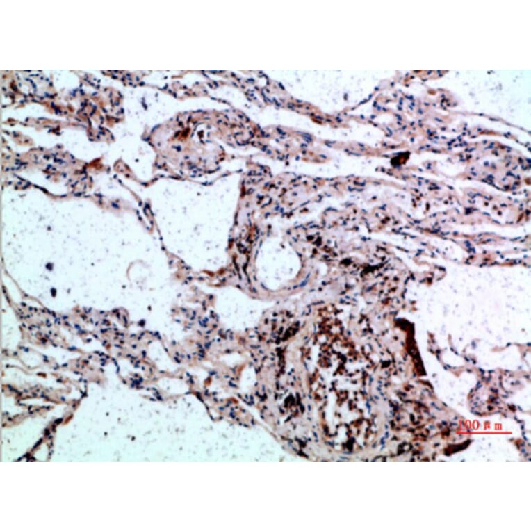 Immunohistochemistry - Anti-CSNK1A1 Antibody (C30815) - Antibodies.com