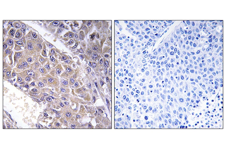Immunohistochemistry - Anti-B4GALT3 Antibody (C14725) - Antibodies.com