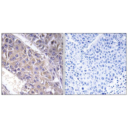 Immunohistochemistry - Anti-B4GALT3 Antibody (C14725) - Antibodies.com