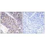 Immunohistochemistry - Anti-B4GALT3 Antibody (C14725) - Antibodies.com