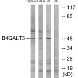 Western Blot - Anti-B4GALT3 Antibody (C14725) - Antibodies.com