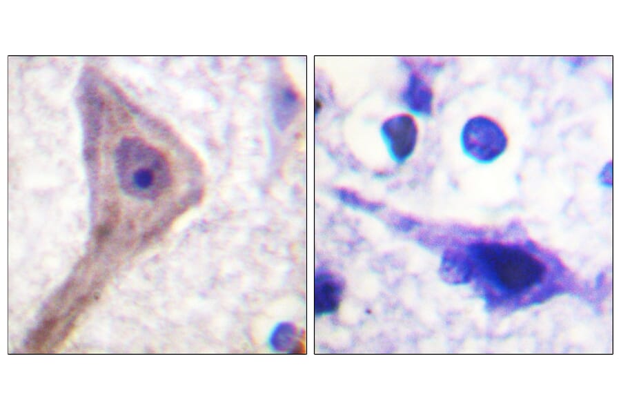 Immunohistochemistry - Anti-Akt1 S1 Antibody (B0453) - Antibodies.com