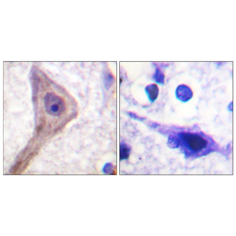 Immunohistochemistry - Anti-Akt1 S1 Antibody (B0453) - Antibodies.com