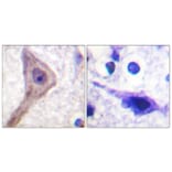 Immunohistochemistry - Anti-Akt1 S1 Antibody (B0453) - Antibodies.com