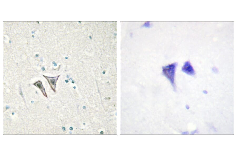 Immunohistochemistry - Anti-ACTR-1C Antibody (C11368) - Antibodies.com