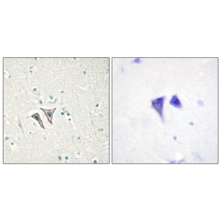 Immunohistochemistry - Anti-ACTR-1C Antibody (C11368) - Antibodies.com