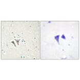 Immunohistochemistry - Anti-ACTR-1C Antibody (C11368) - Antibodies.com