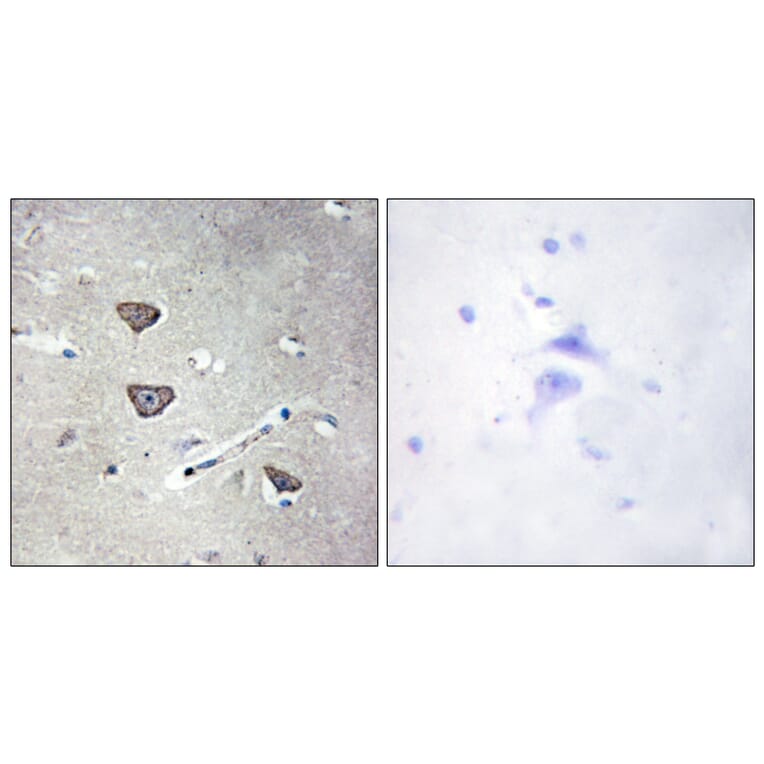 Immunohistochemistry - Anti-5-HT-2C Antibody (C12015) - Antibodies.com