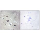 Immunohistochemistry - Anti-5-HT-2C Antibody (C12015) - Antibodies.com