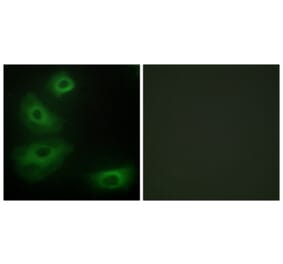 Immunofluorescence - Anti-5-HT-1B Antibody (C12009) - Antibodies.com