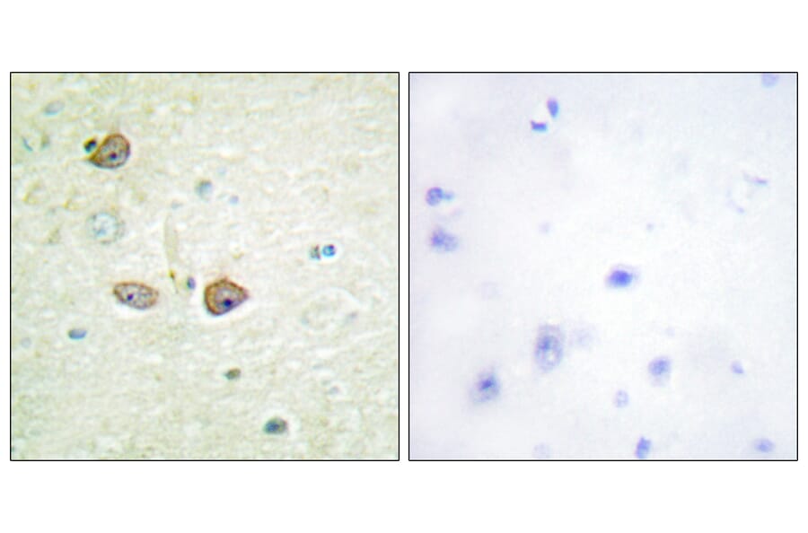 Immunohistochemistry - Anti-5-HT-1B Antibody (C12009) - Antibodies.com