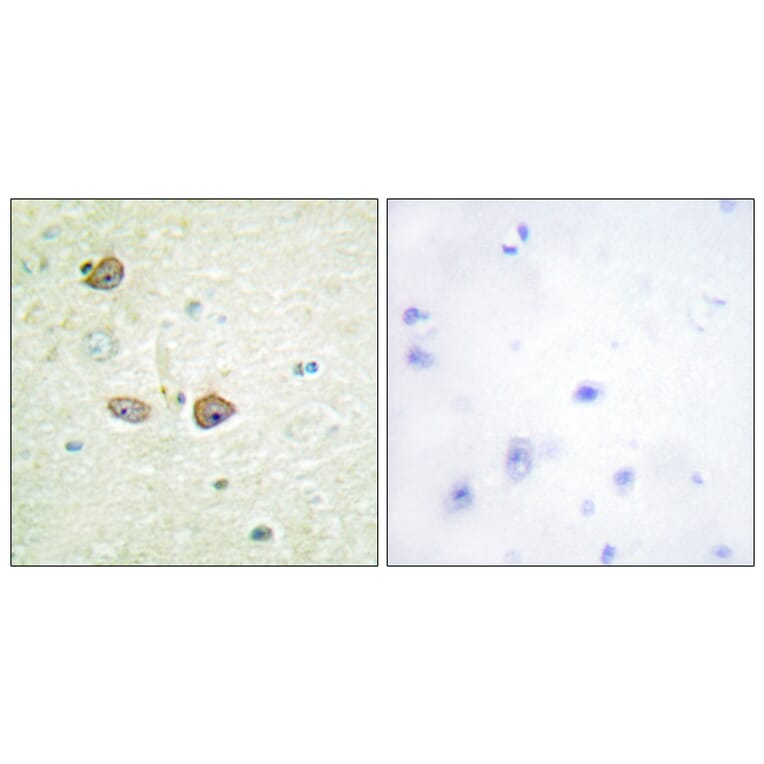 Immunohistochemistry - Anti-5-HT-1B Antibody (C12009) - Antibodies.com