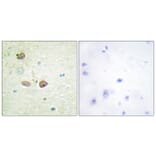 Immunohistochemistry - Anti-5-HT-1B Antibody (C12009) - Antibodies.com