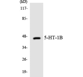 Western Blot - Anti-5-HT-1B Antibody (R12-2419) - Antibodies.com