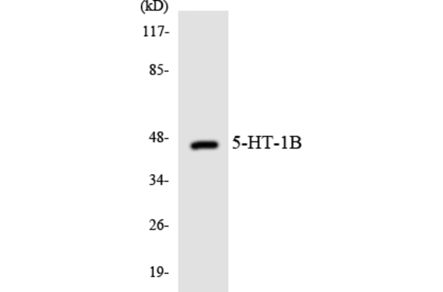Western Blot - Anti-5-HT-1B Antibody (R12-2419) - Antibodies.com