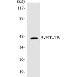 Western Blot - Anti-5-HT-1B Antibody (R12-2419) - Antibodies.com