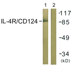 Western Blot - Anti-IL-4RAntibody (B1064) - Antibodies.com