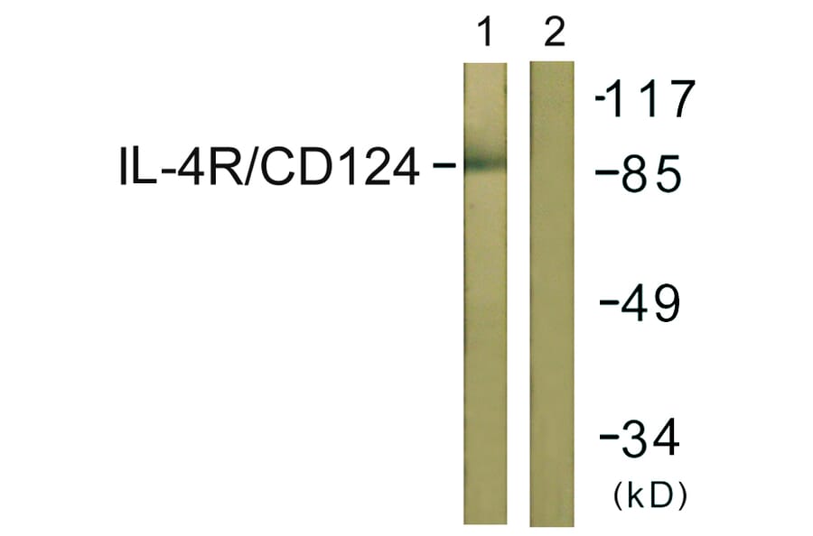 Western Blot - Anti-IL-4RAntibody (B1064) - Antibodies.com